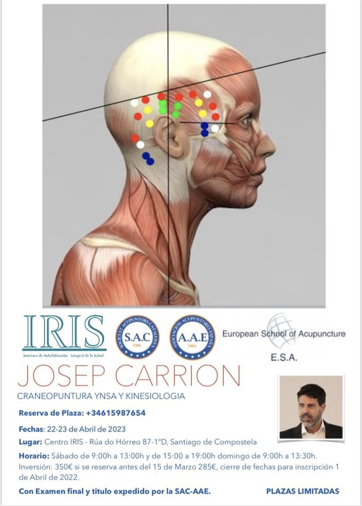 Craneopuntura YNSA y Kinesiologia 