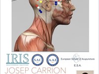 Craneopuntura YNSA y Kinesiologia 