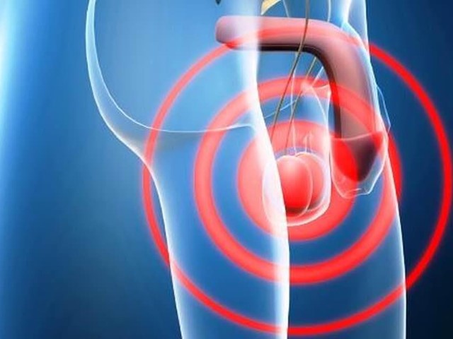 De un dolor de testículos a una molestia en el abdomen. El extraño camino para llegar a eso 