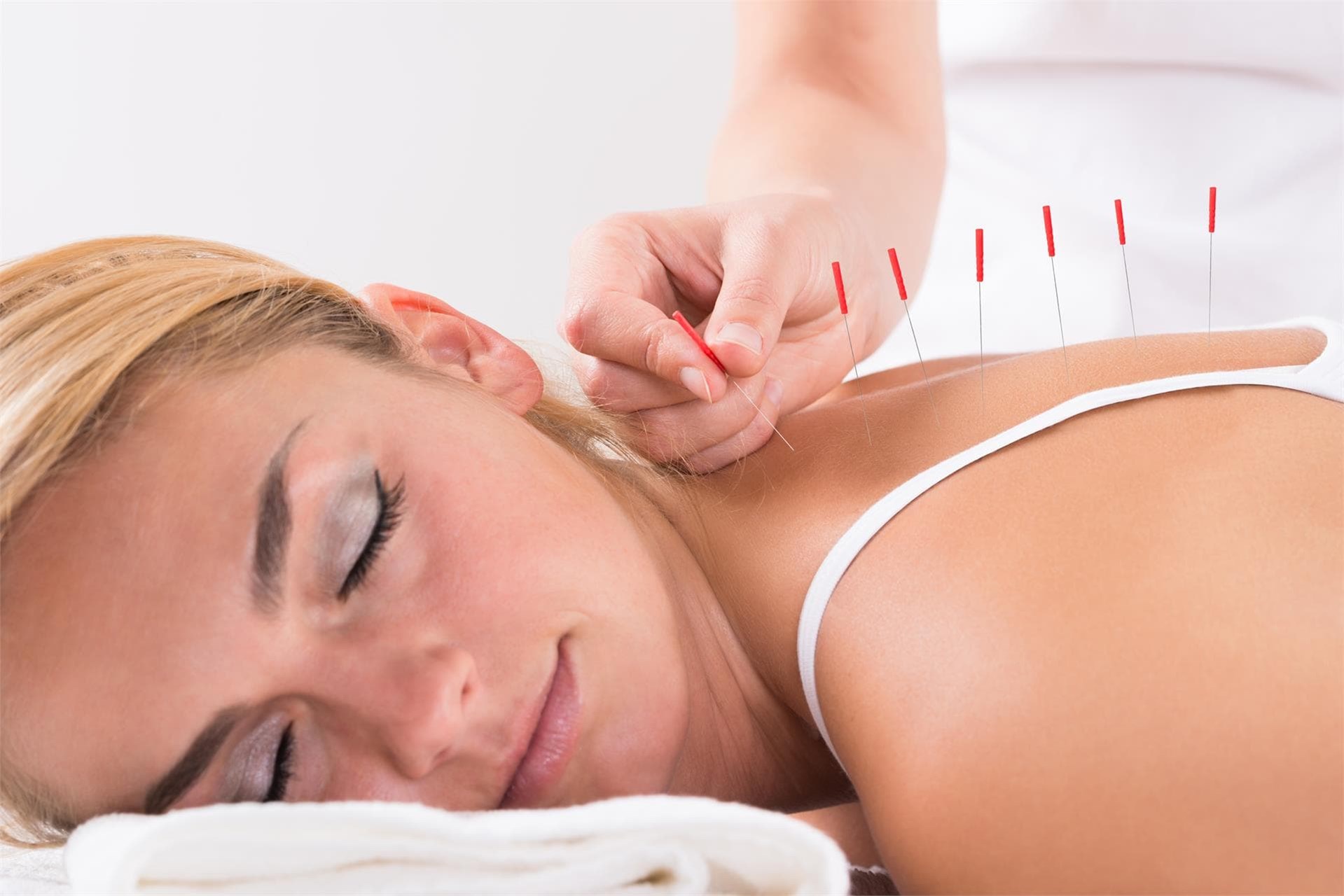 Las técnicas más beneficiosas en acupuntura