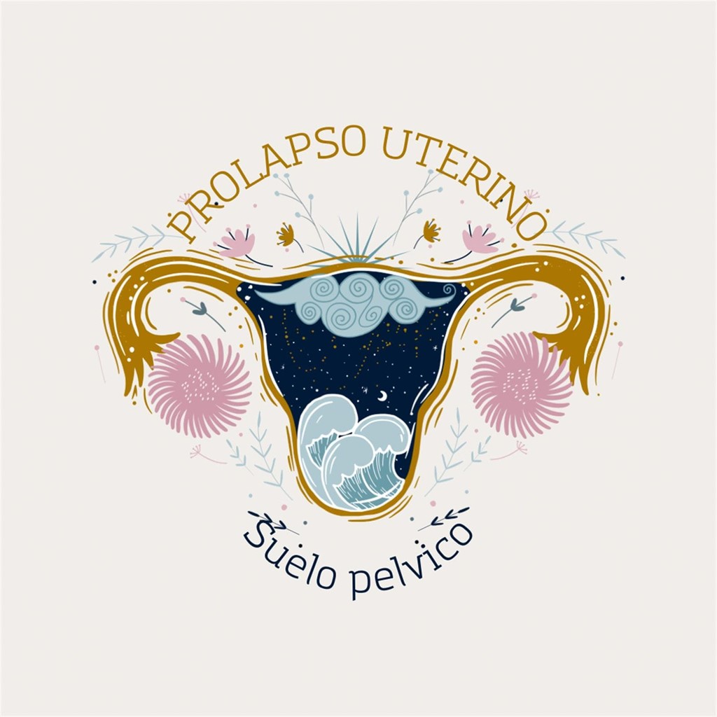 Que es un prolapso de útero