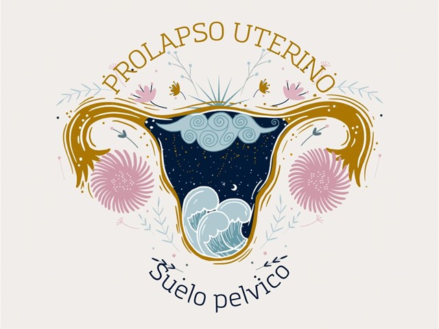 Que es un prolapso de útero