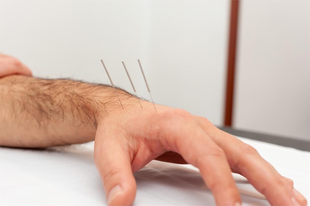 ¿Qué podemos tratar con la acupuntura?
