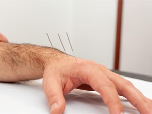 ¿Qué podemos tratar con la acupuntura?