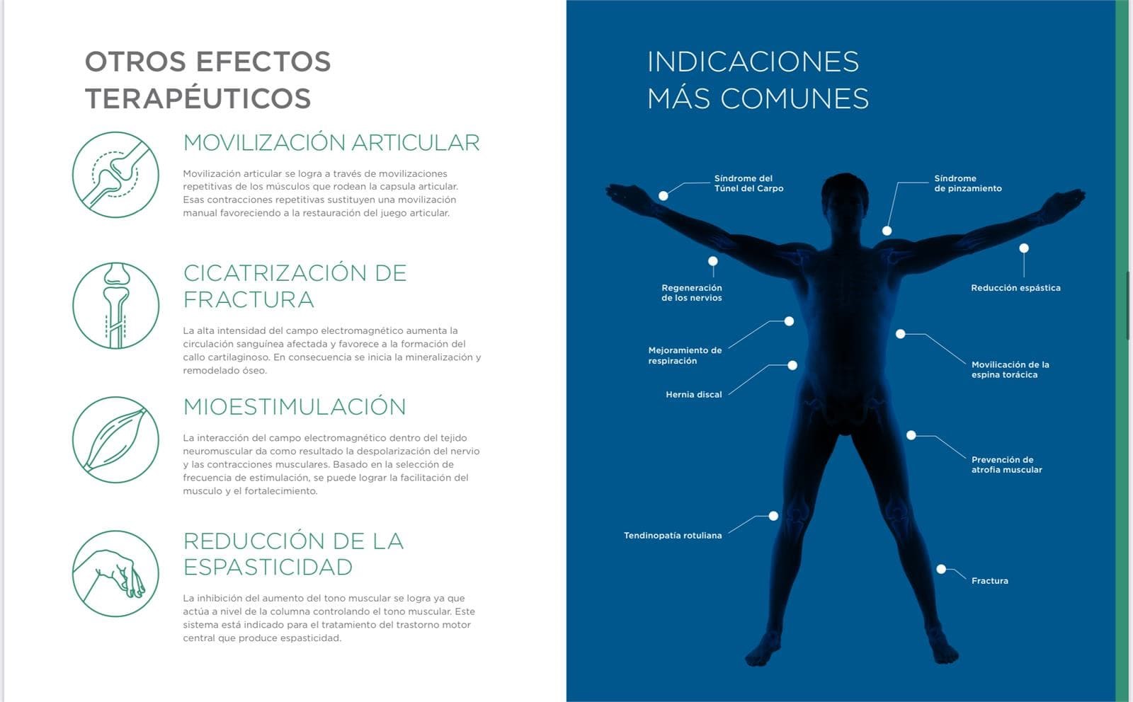 Sistema Súper Inductivo ( SIS ) - Imagen 1